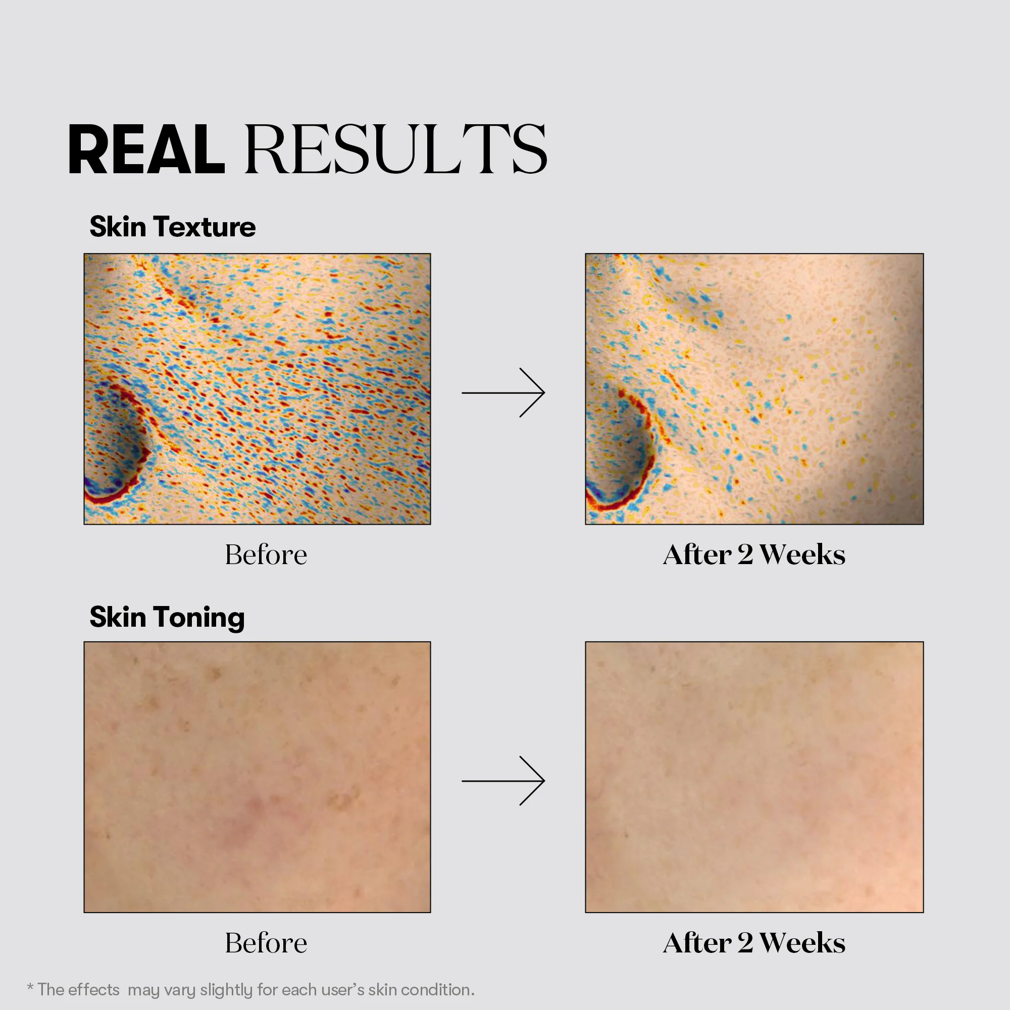 Tx-toning Daily Mask - Image 5